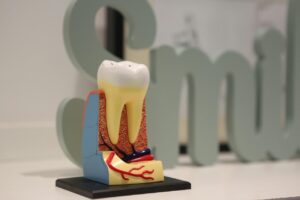 Bite Collapse From Missing Molars: What You Need to Know