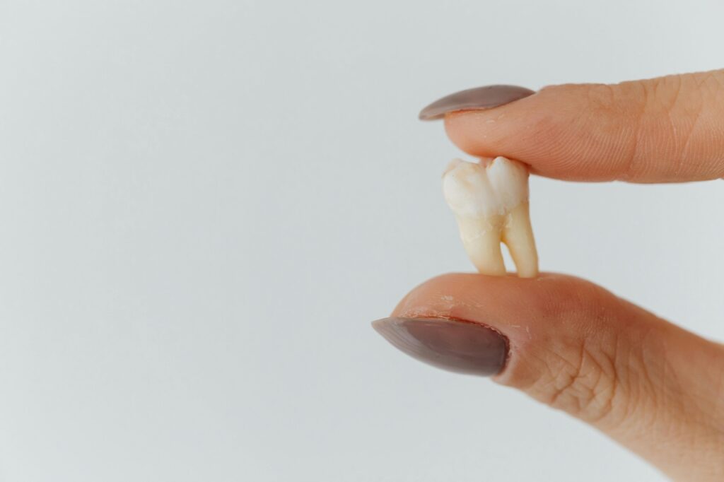 The Psychology of Losing a Tooth as an Adult