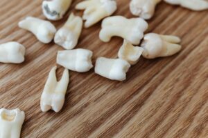 Tooth Replacement Options After Tooth Loss